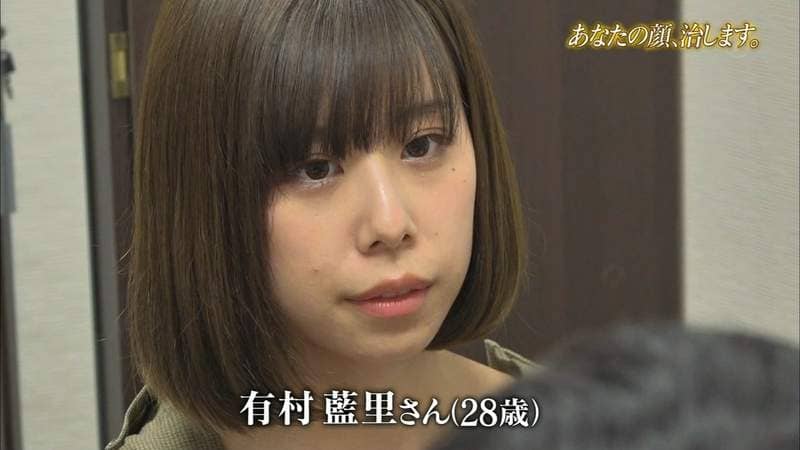 有村架纯姊姊《有村蓝里》公开整形　总被拿来跟妹妹比较的外表终于重拾自信