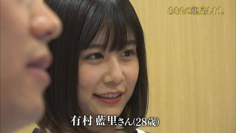 有村架纯姊姊《有村蓝里》公开整形　总被拿来跟妹妹比较的外表终于重拾自信