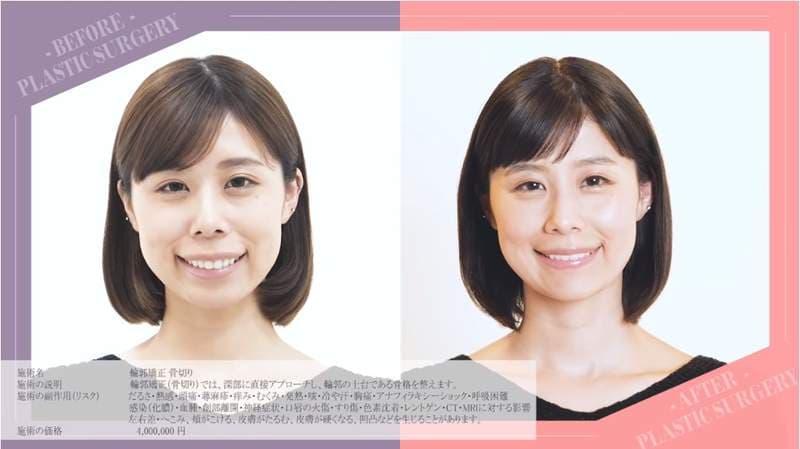 有村架纯姊姊《有村蓝里》公开整形　总被拿来跟妹妹比较的外表终于重拾自信