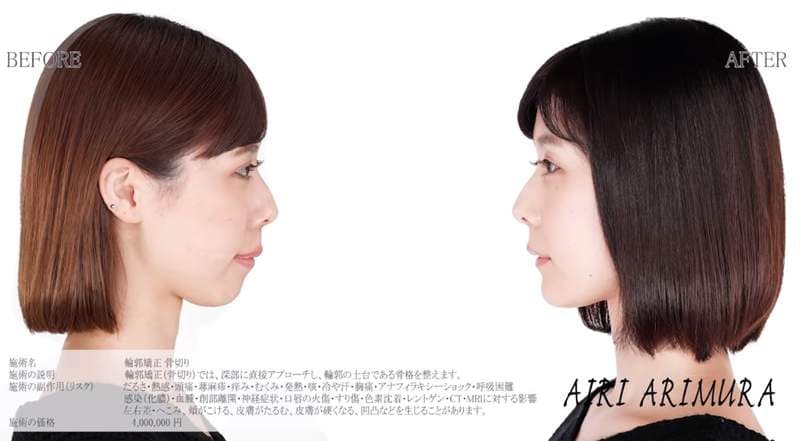 有村架纯姊姊《有村蓝里》公开整形　总被拿来跟妹妹比较的外表终于重拾自信