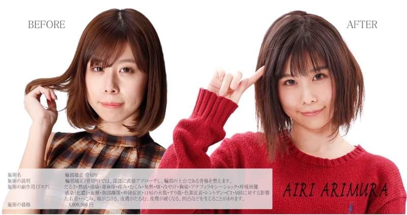 有村架纯姊姊《有村蓝里》公开整形　总被拿来跟妹妹比较的外表终于重拾自信