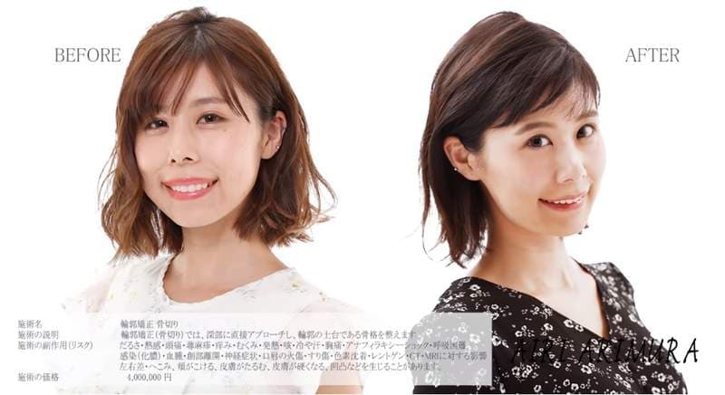 有村架纯姊姊《有村蓝里》公开整形　总被拿来跟妹妹比较的外表终于重拾自信