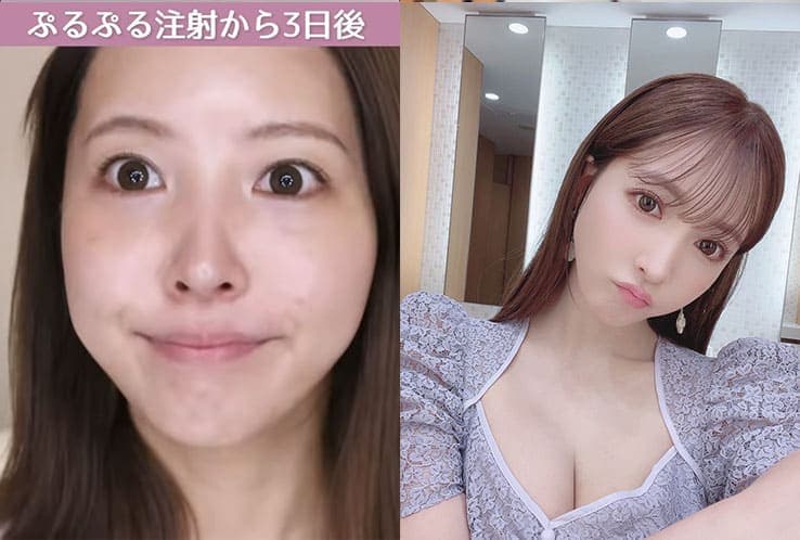 日本AV女神【三上悠亚】高清素颜照！微整过程大公开