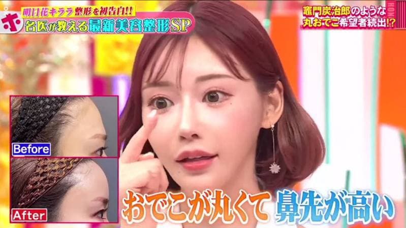 前AV女优明日花绮罗首认整型 受《鬼灭之刃》影响竟成动刀典范